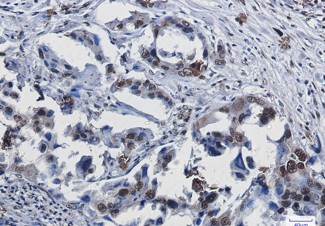IHC - SUMO1 Rabbit mAb AP76133